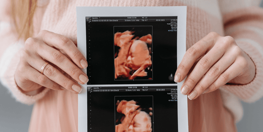 Tips voor de 1e en 2e maand van je zwangerschap (week 1-8)